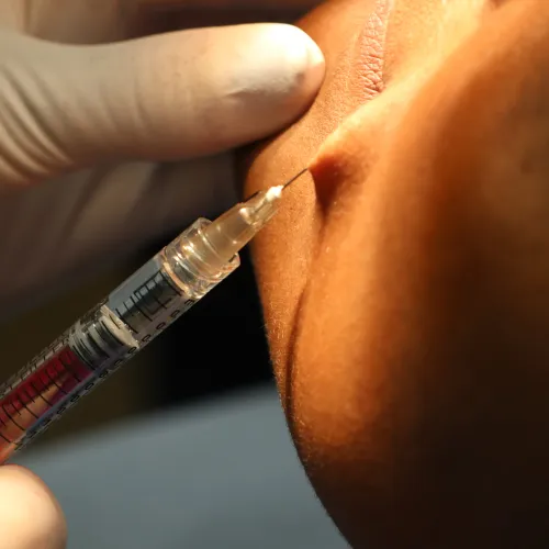 Armonización Orofacial