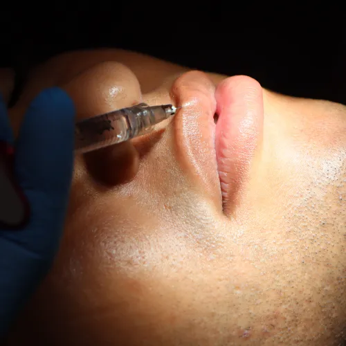 Armonización Orofacial
