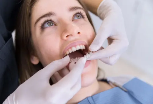 ALIGNER PRO ACADEMY