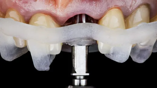 Especialista en Odontología Digital y Cirugía Guiada