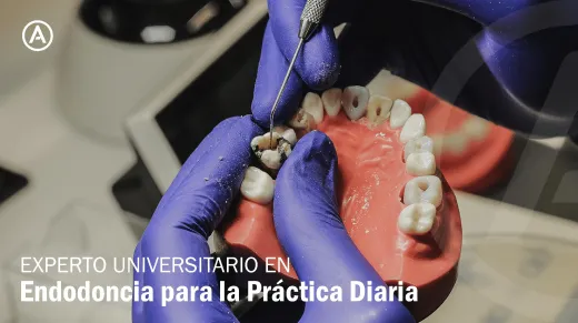 Experto Universitario en Endodoncia para la práctica diaria (2027)