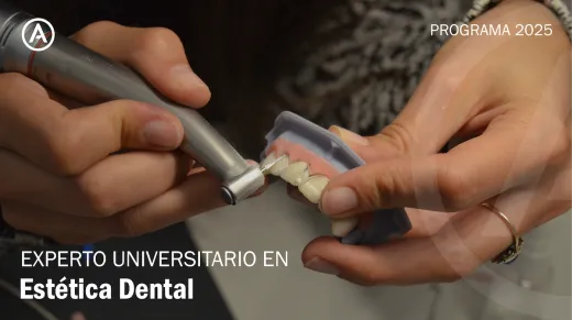 Experto Universitario en Estética Dental