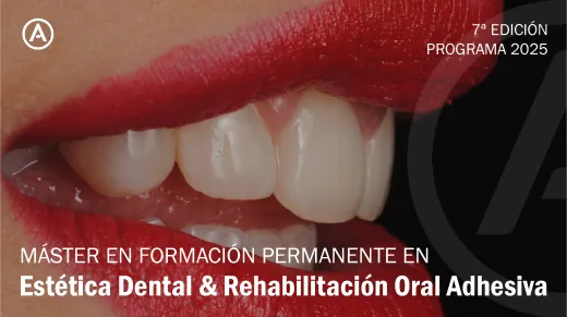 Máster en Formación Permanente en Estética Dental & Rehabilitación Oral Adhesiva