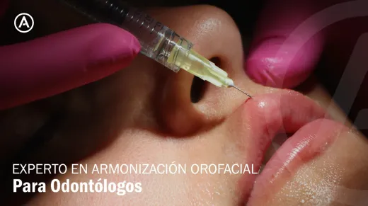 Experto en Armonización Orofacial Para Odontólogos