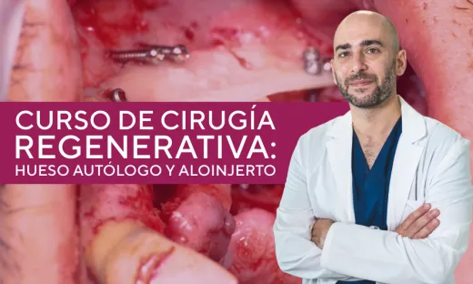 Cirugía regenerativa: hueso autólogo y aloinjerto