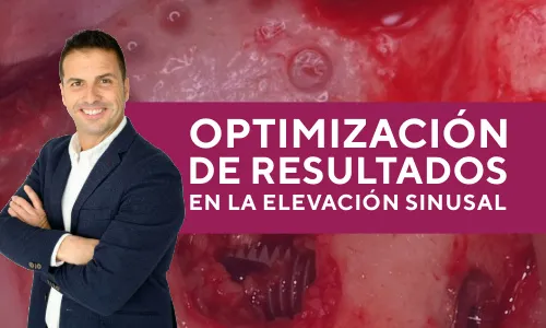 Optimización de resultados en la elevación sinusal: paso a paso