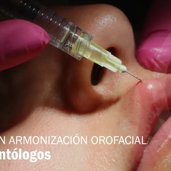 Experto en Armonización Orofacial Para Odontólogos