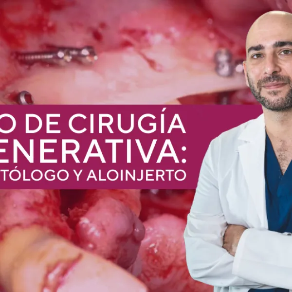 Cirugía regenerativa: hueso autólogo y aloinjerto